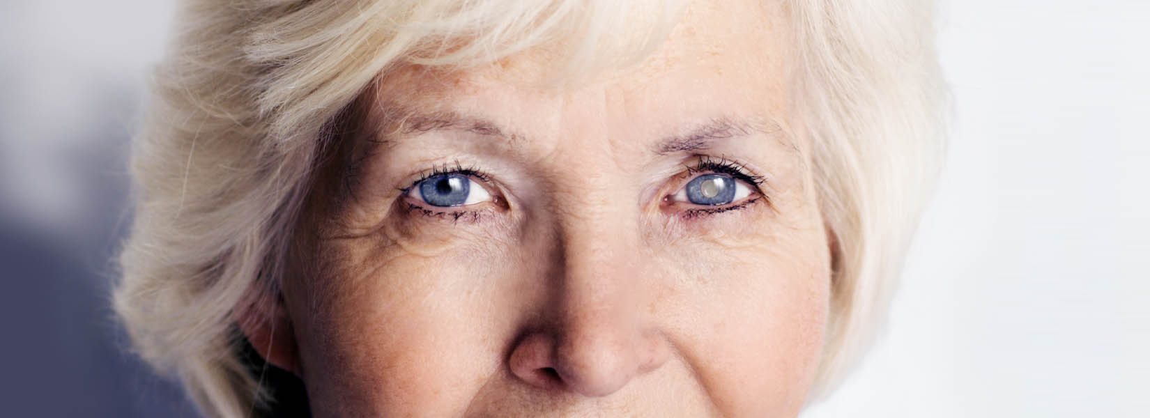Cataract Surgery in Orland Park